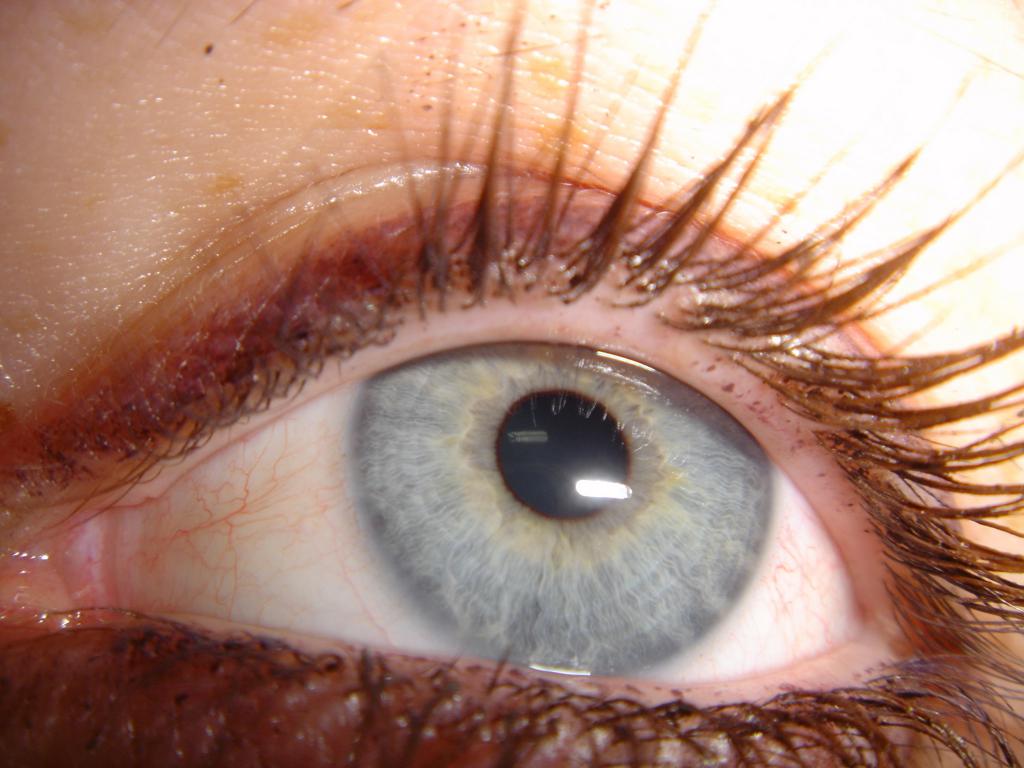 eye of penelope