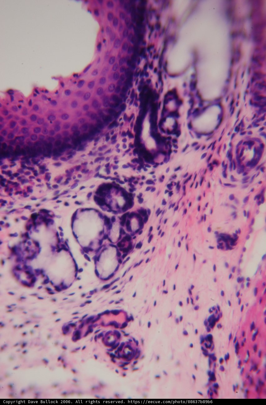Purple Tissue Pattern