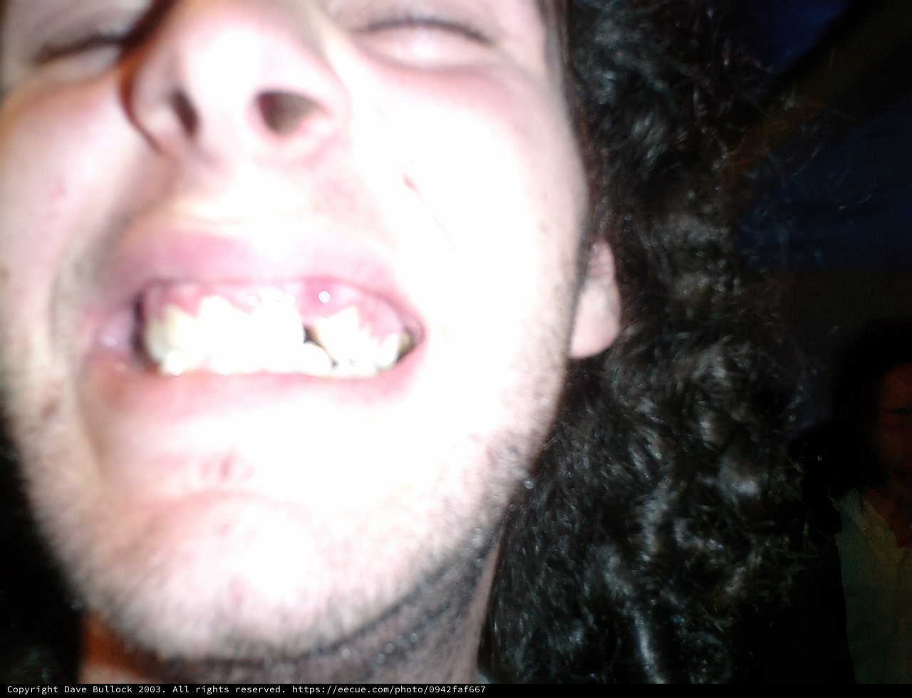 Bearded Man with Teeth Bared