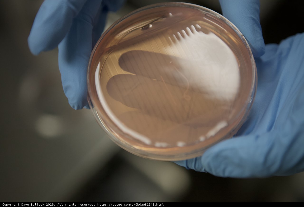 Gloved Hand Holds Petri Dish