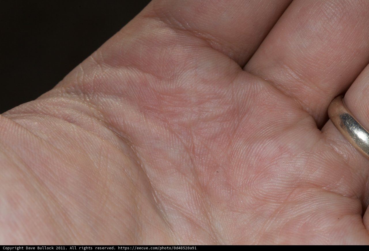 A Ring on a Hand
