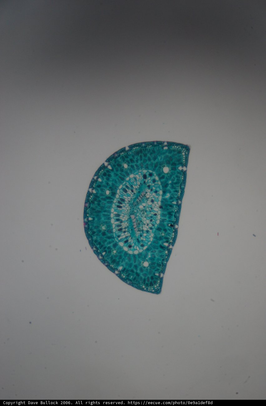 Treasured Turquoise Cap