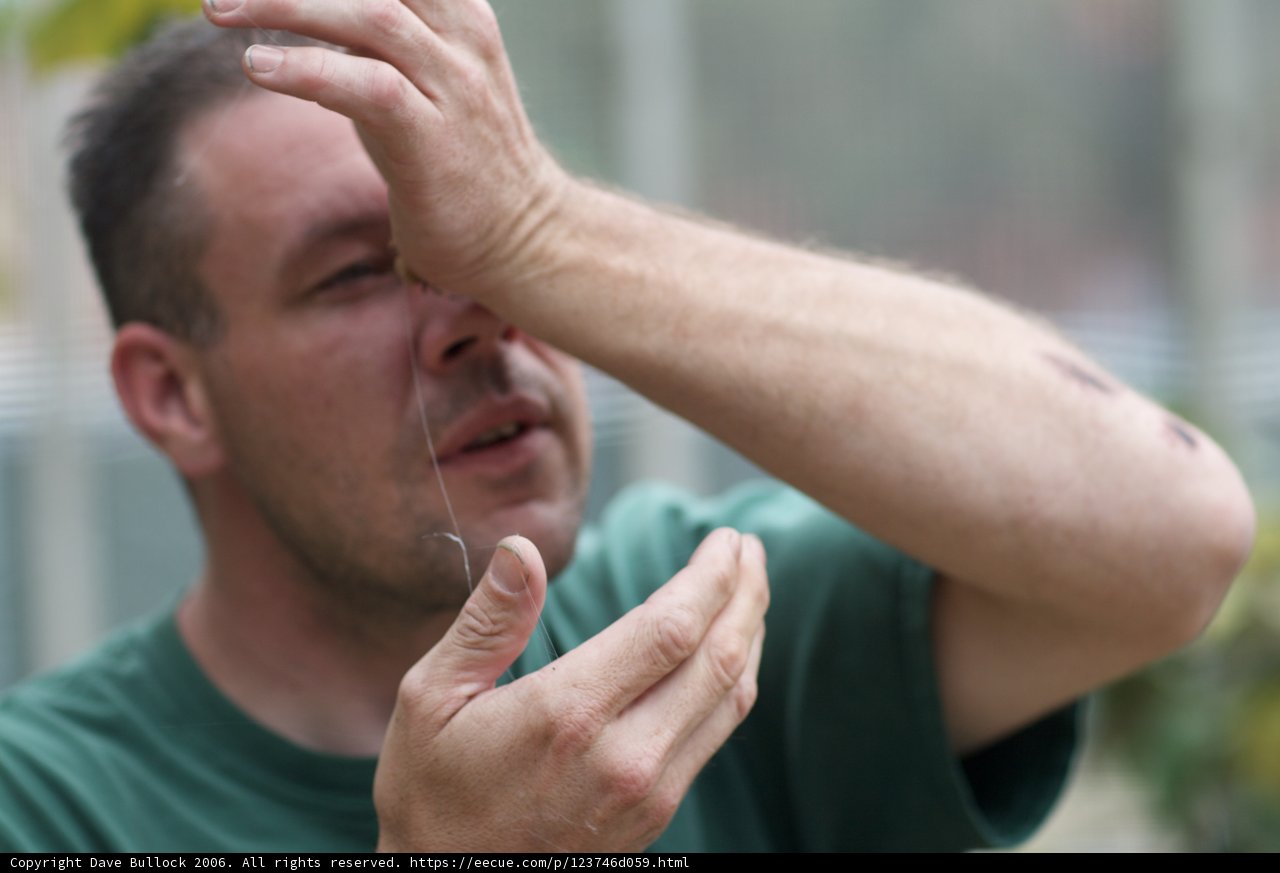 Injured Man