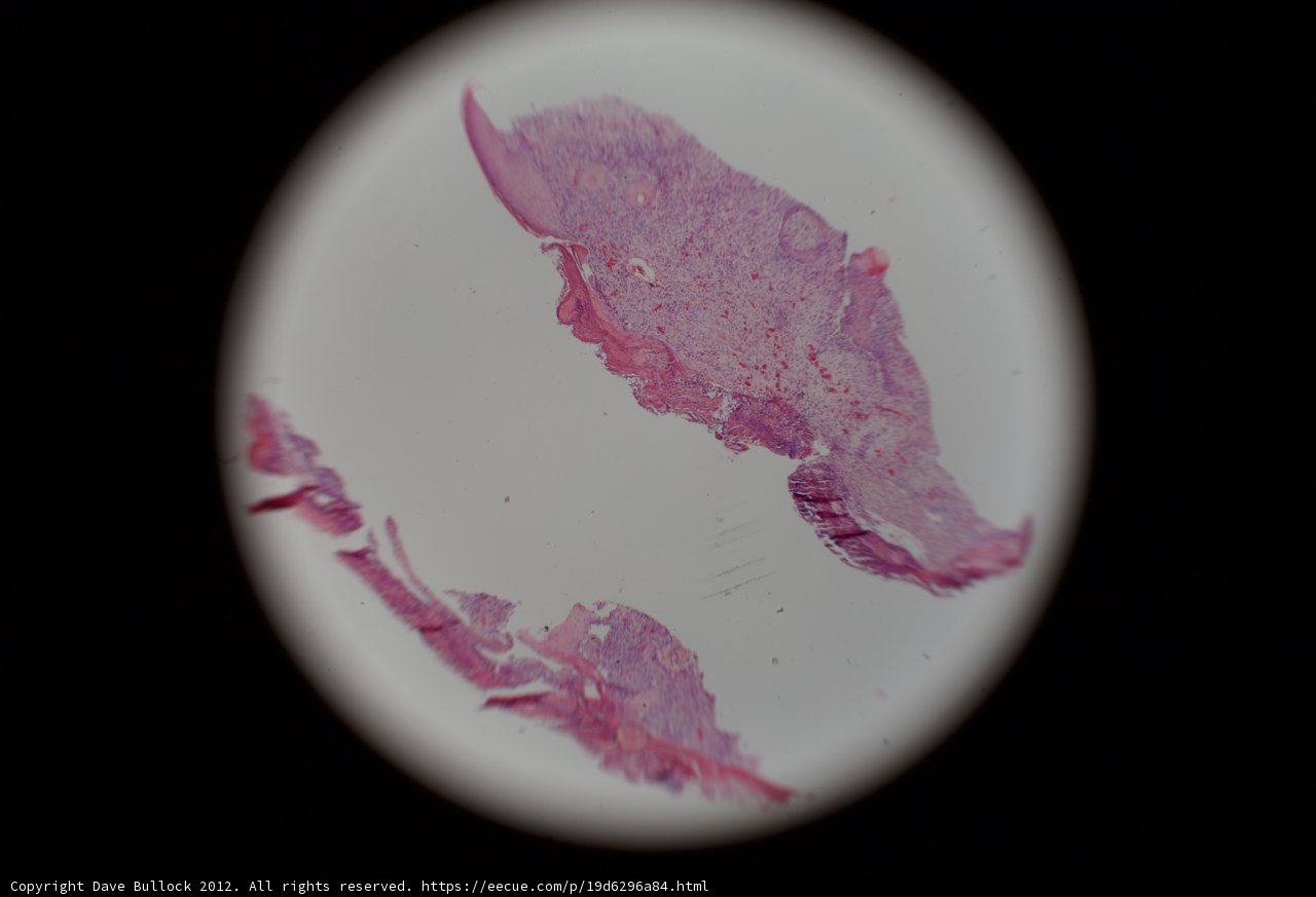 Vividly Stained Tissue