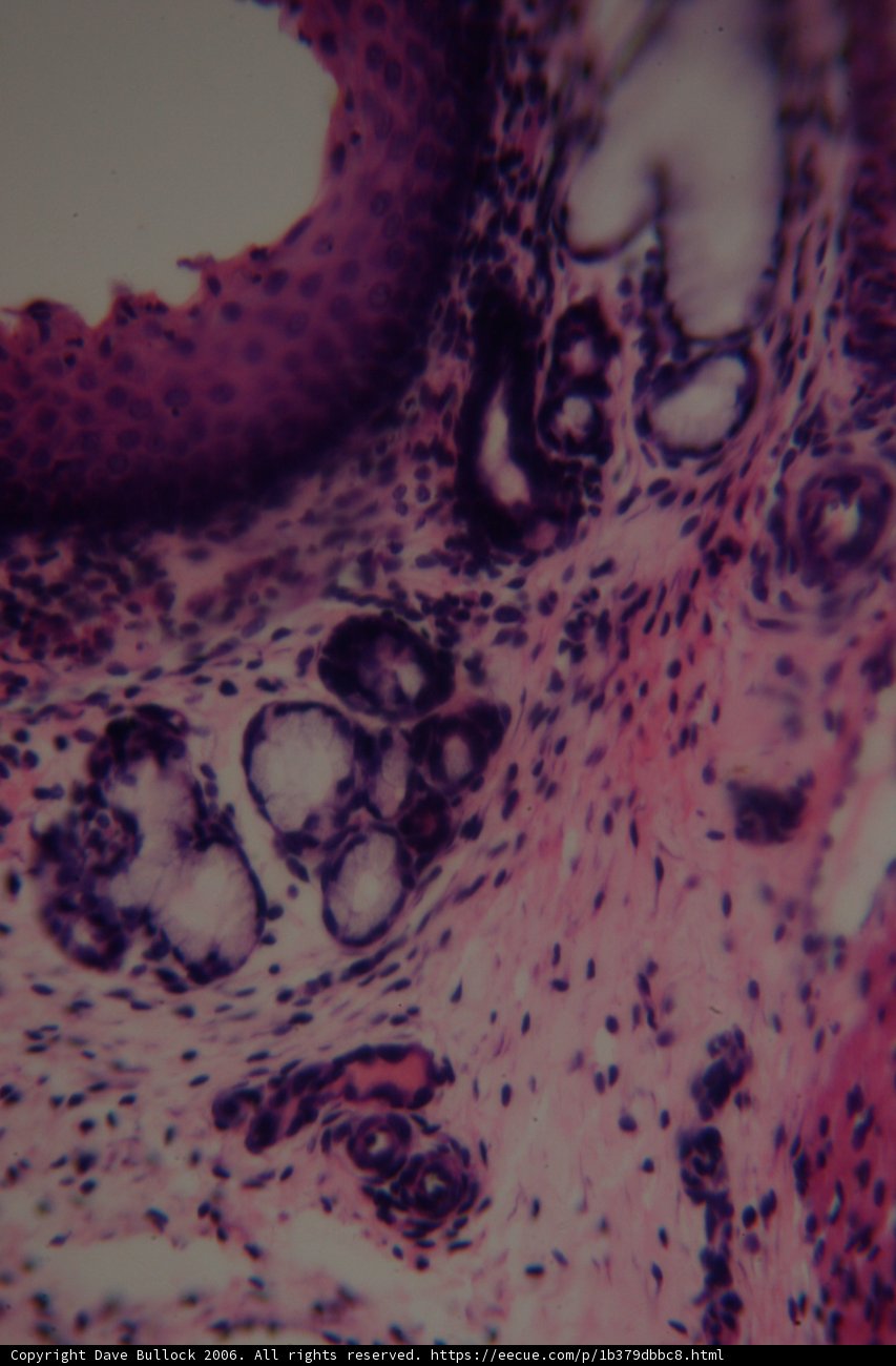 Purple Patterned Tissue