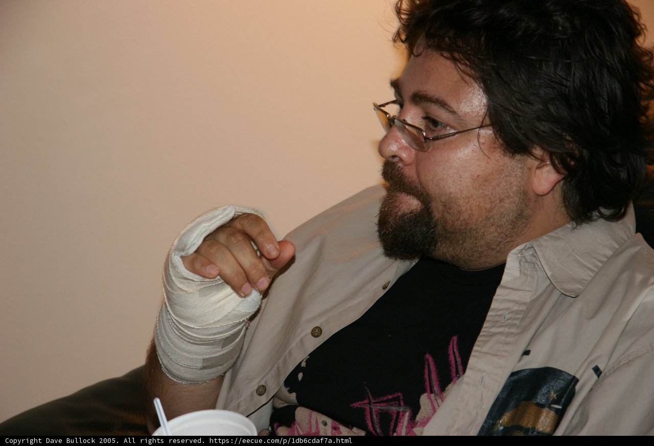 Injured Man with a Bandaged Hand