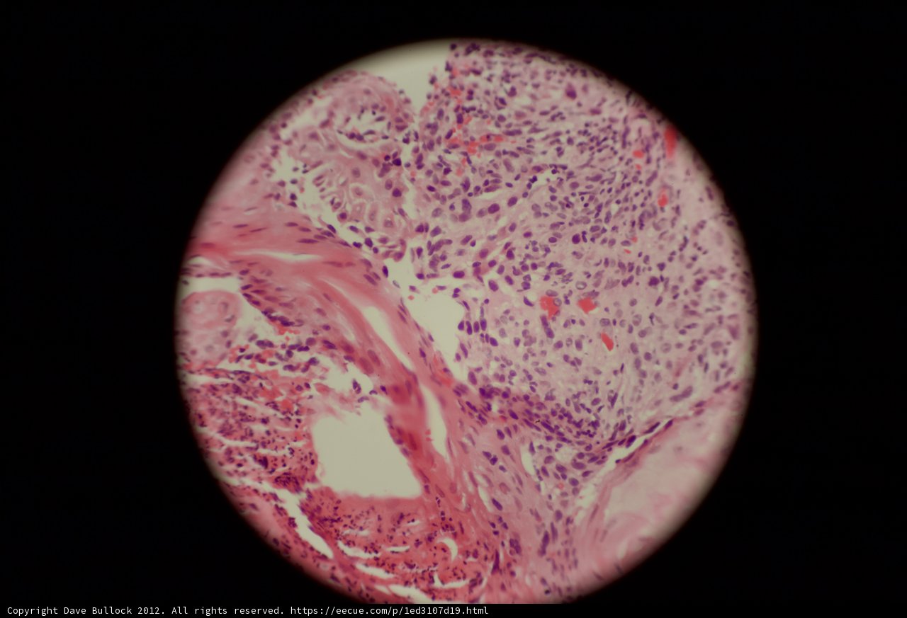 The Circular World of an Egg Tissue