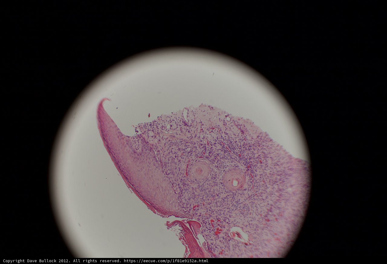Pink and White Stain