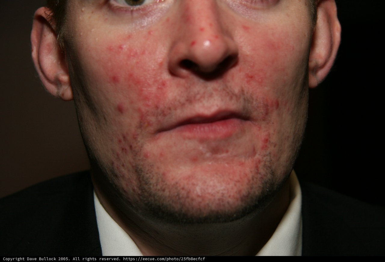 Red-Faced Gentleman