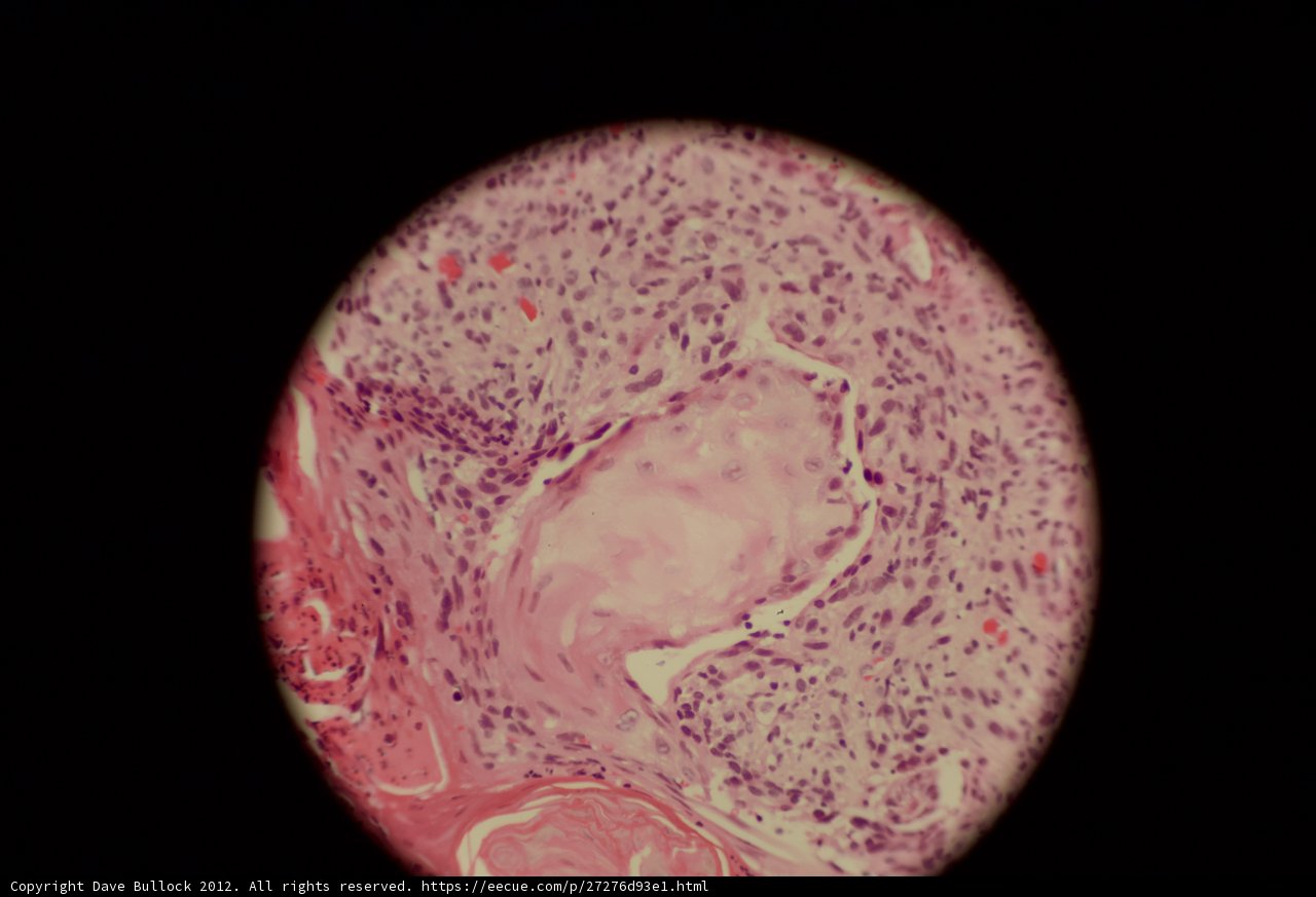 Skin in a Sphere
