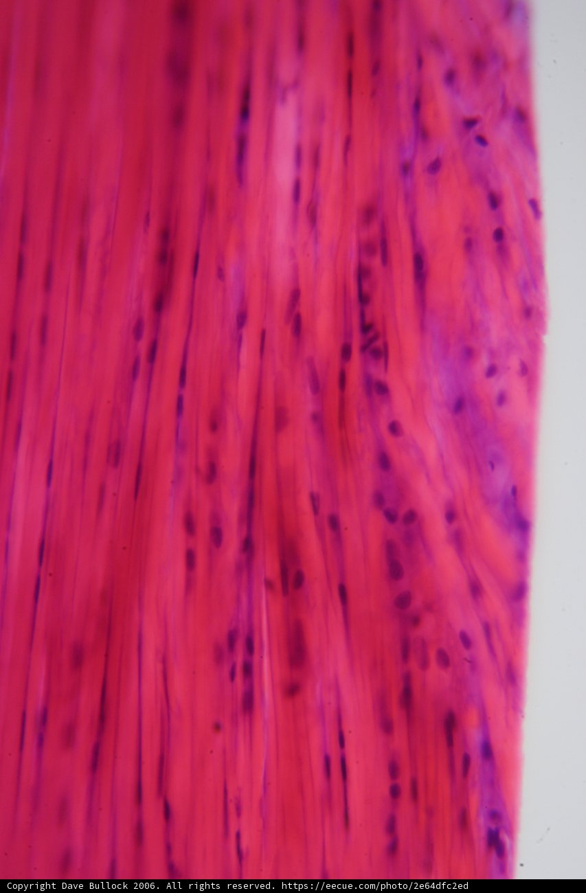 An Intimate Look at a Colored Tissue