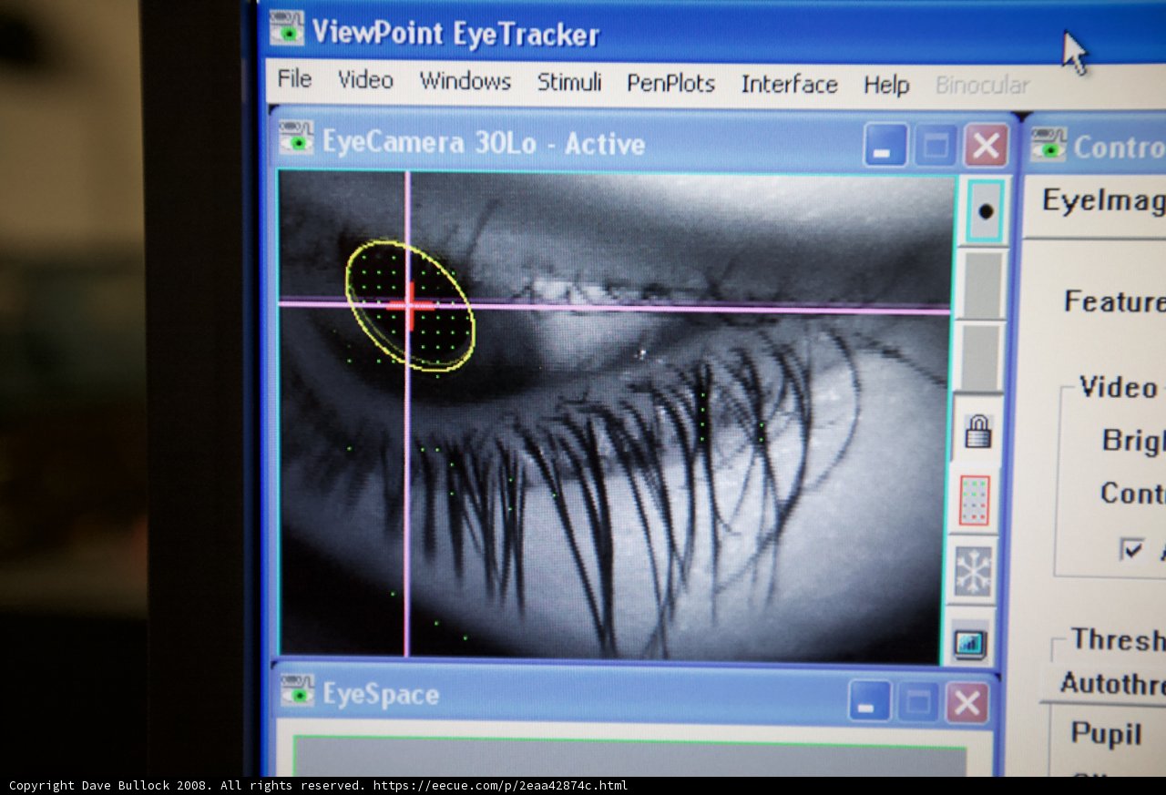 Visualizing Eye Implants on a Computer Screen