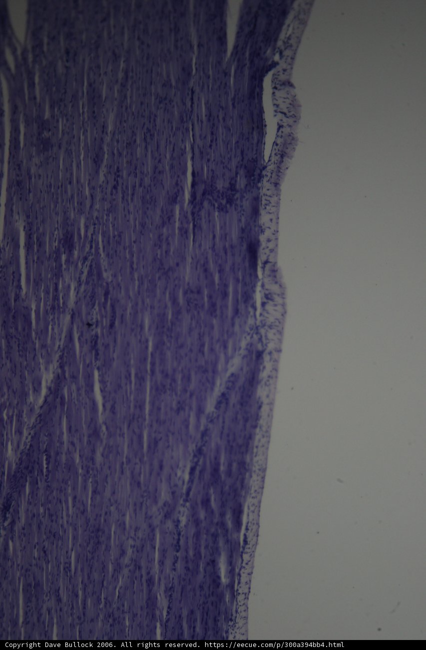 Purple Tissue: A Work of Art