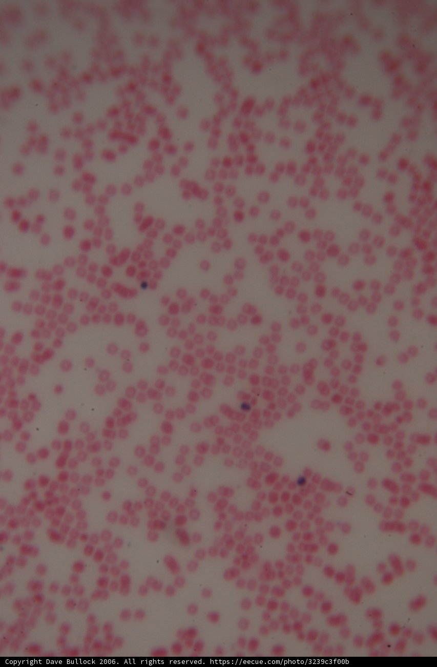 Red and White Cell Close-Up