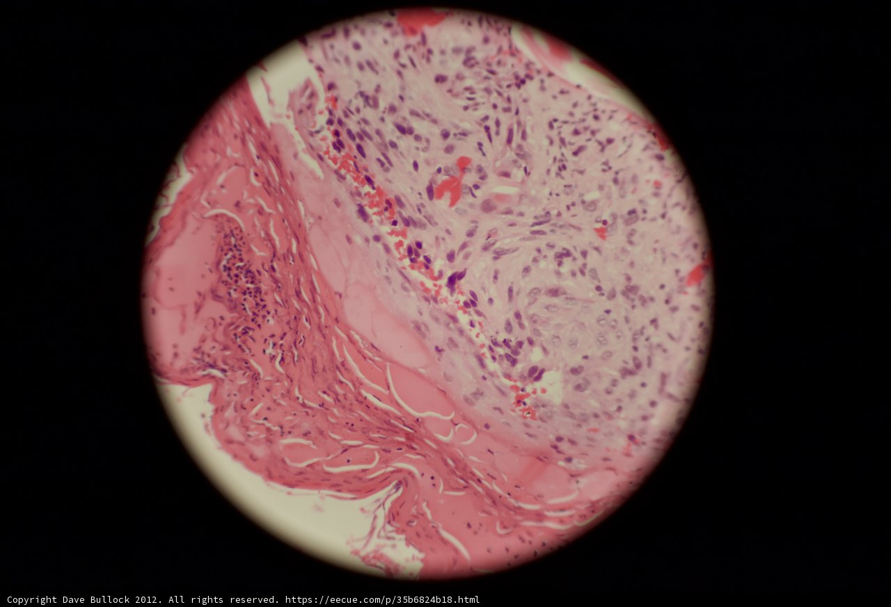 Pink and White Sphere Tissue