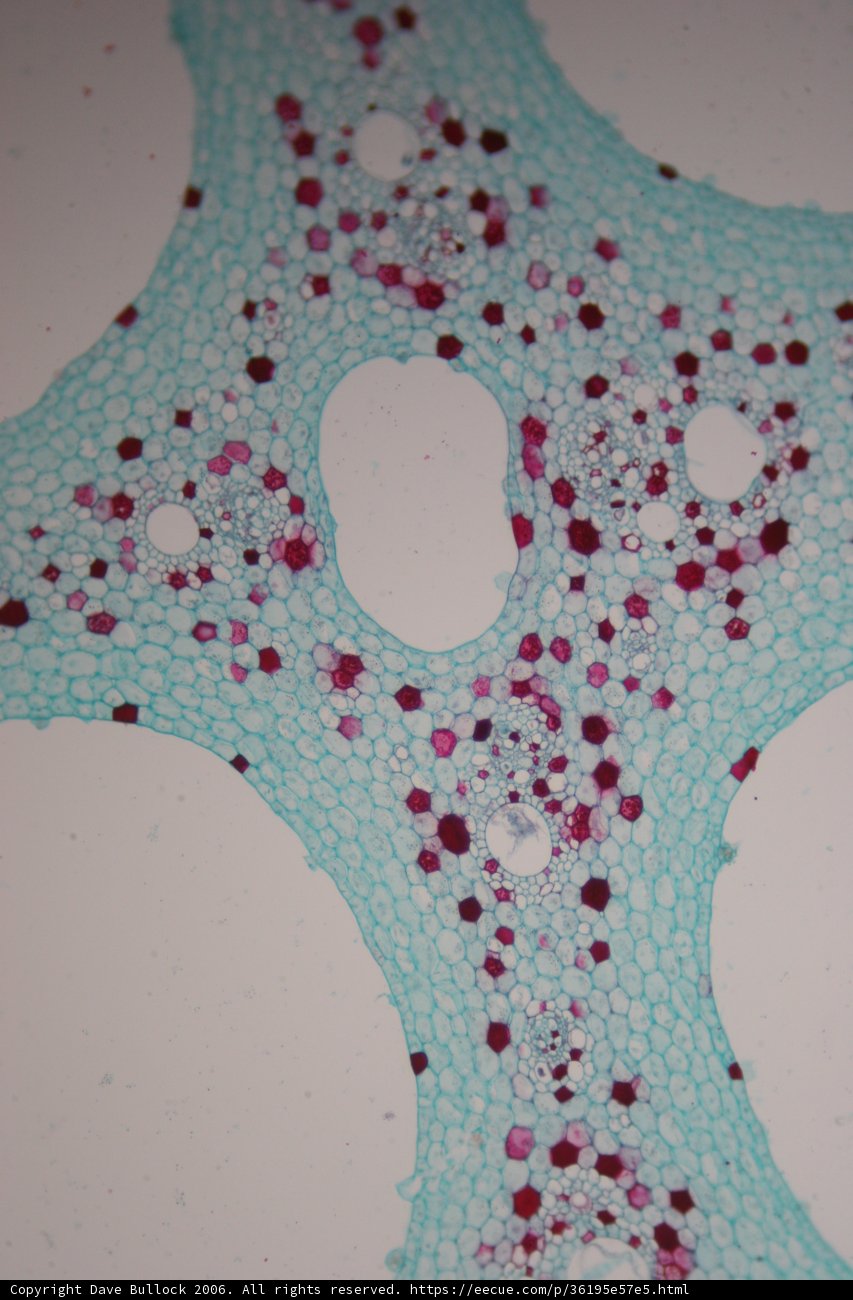 The Spotted World of a Plant Cell