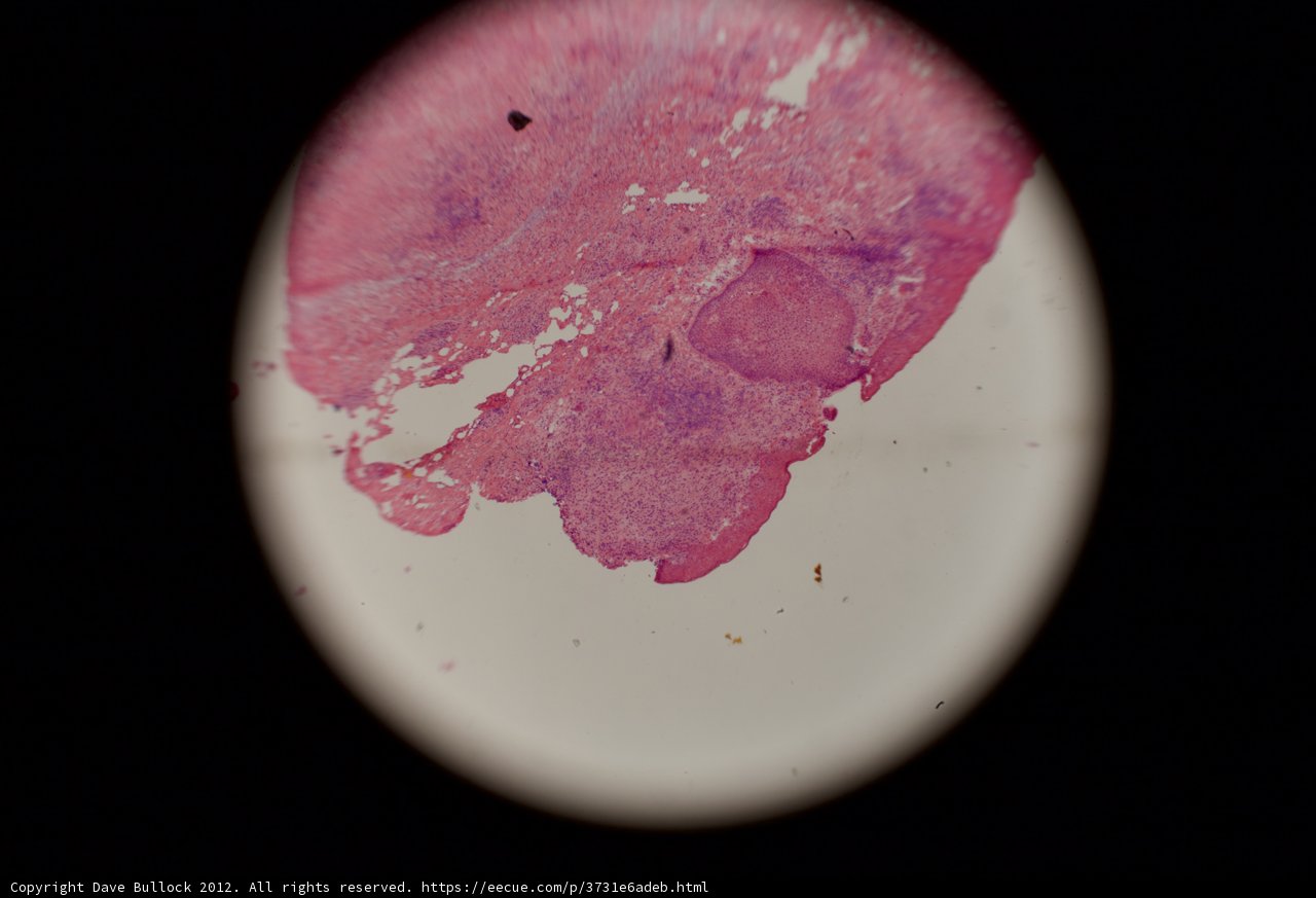 Pink Stain on Black Surface