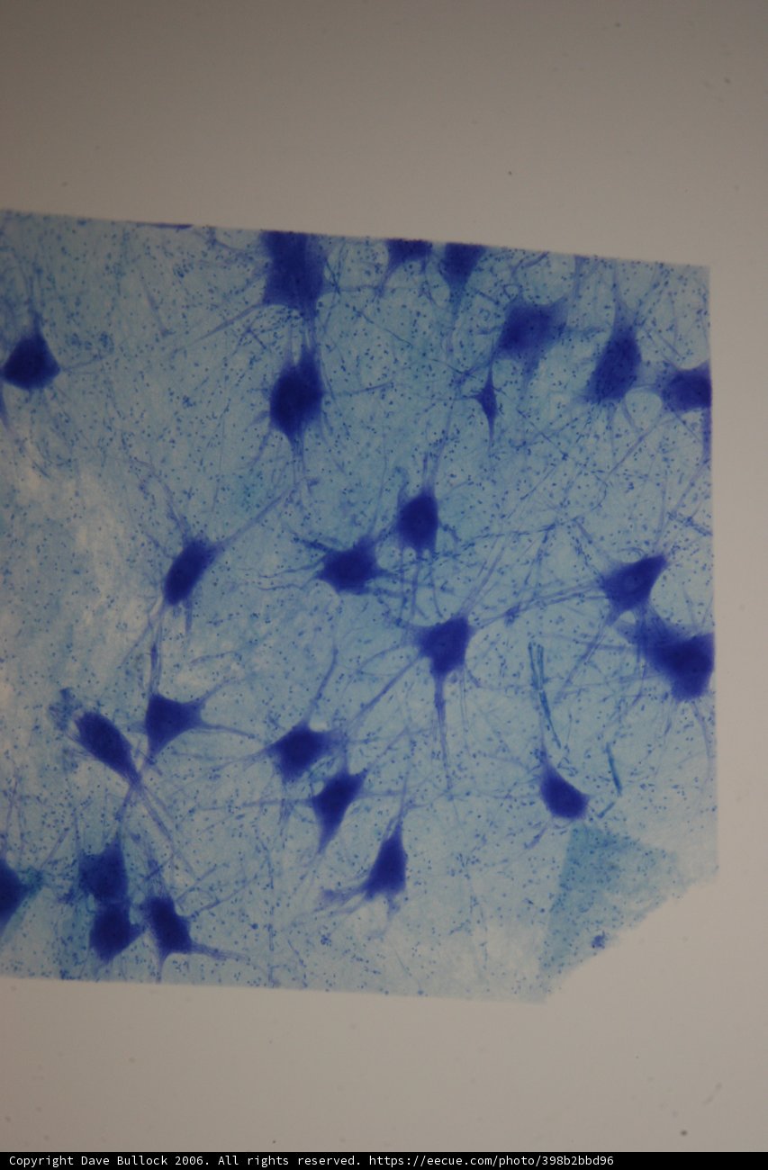 Blue and White Cellular Art
