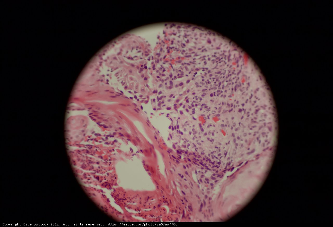 Egg Tissue Sphere