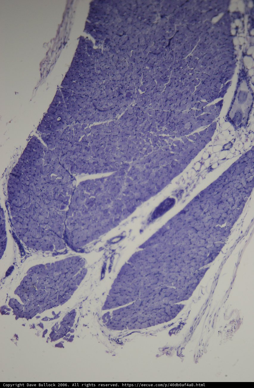 Purple Stained Skin Cell