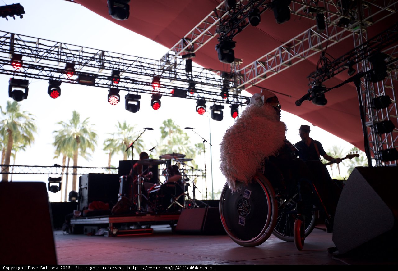 Wheelchair-bound Musician Rocks the Stage