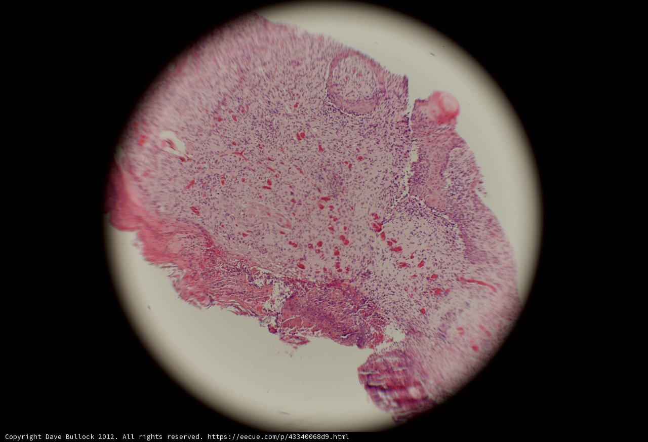 Pink and Red Stained Sphere
