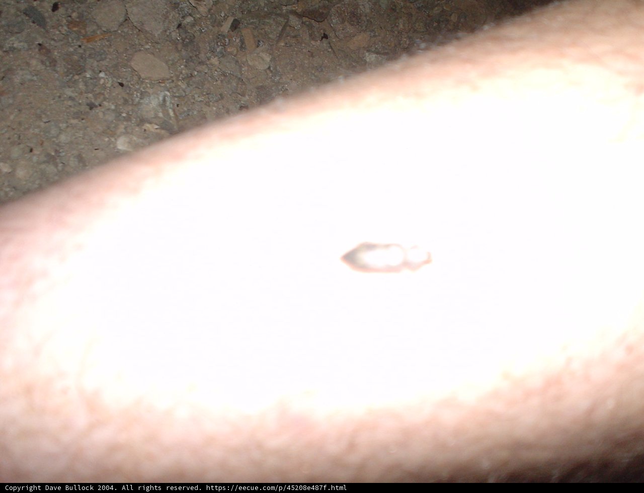 Bug on Man's Arm