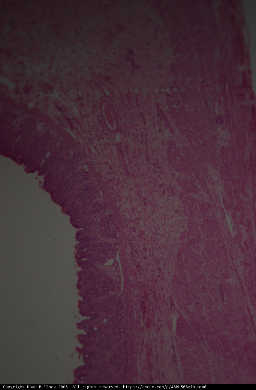 Pink Tissue with White Stripe