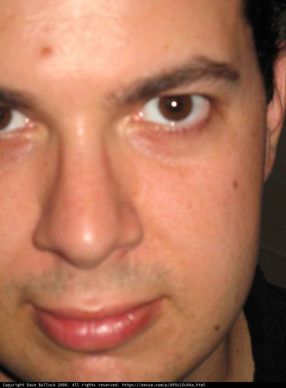 Man with a Freckled Face
