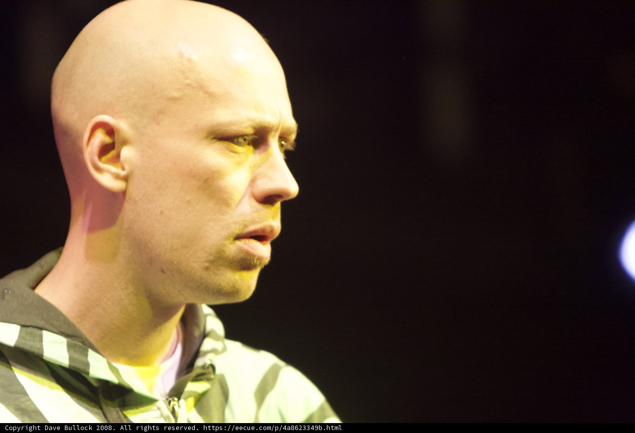 The Bald Striped Shirt Man