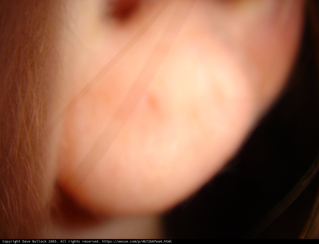 Red Spot on Ear