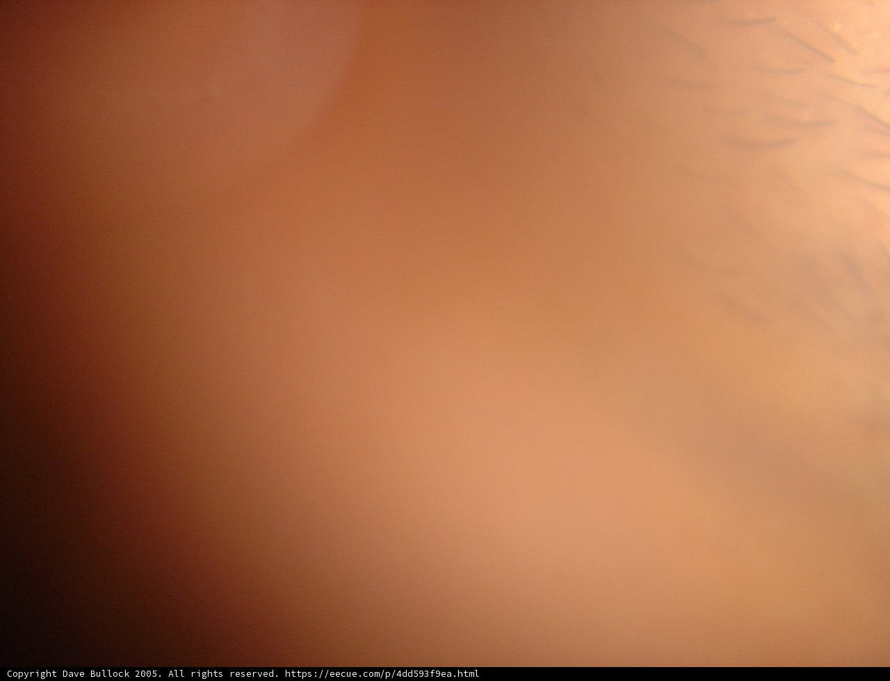 The Intensity of a Tiny Eye