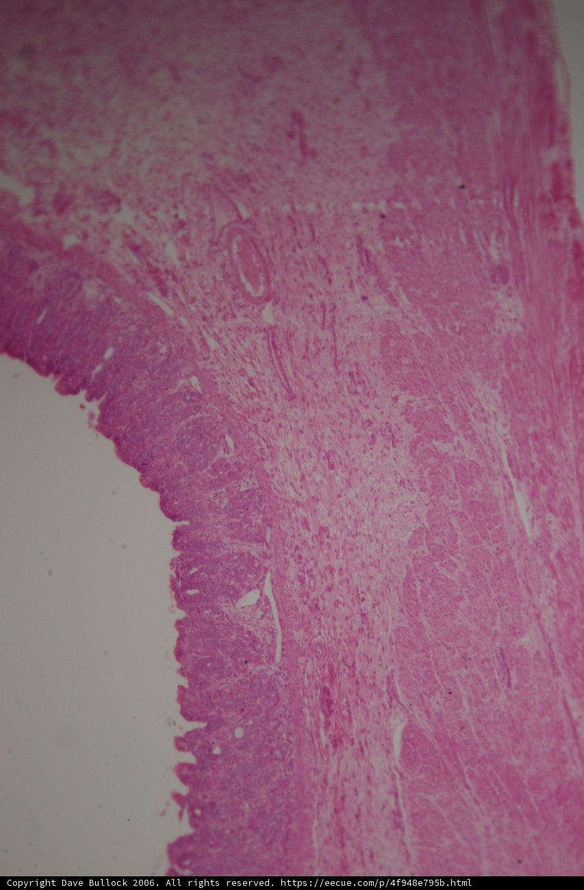 Pink Tissue with a White Line