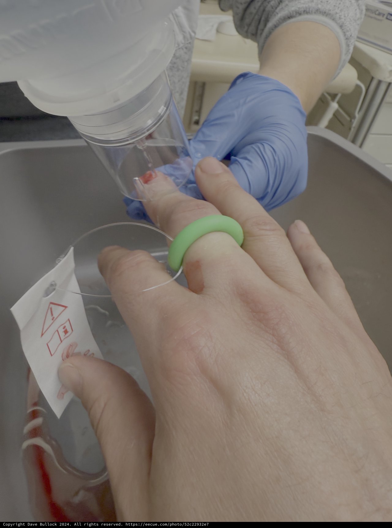 Medical Blood Draw Procedure in Clinical Setting