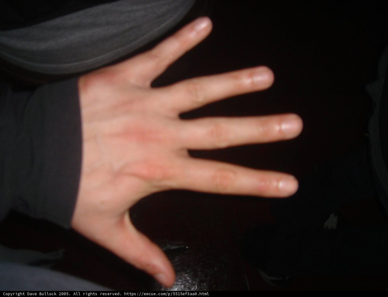 Red Mark on Hand