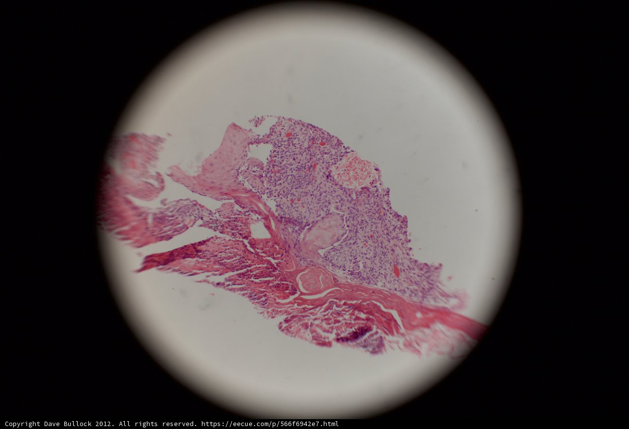Stained Tissue Micrograph