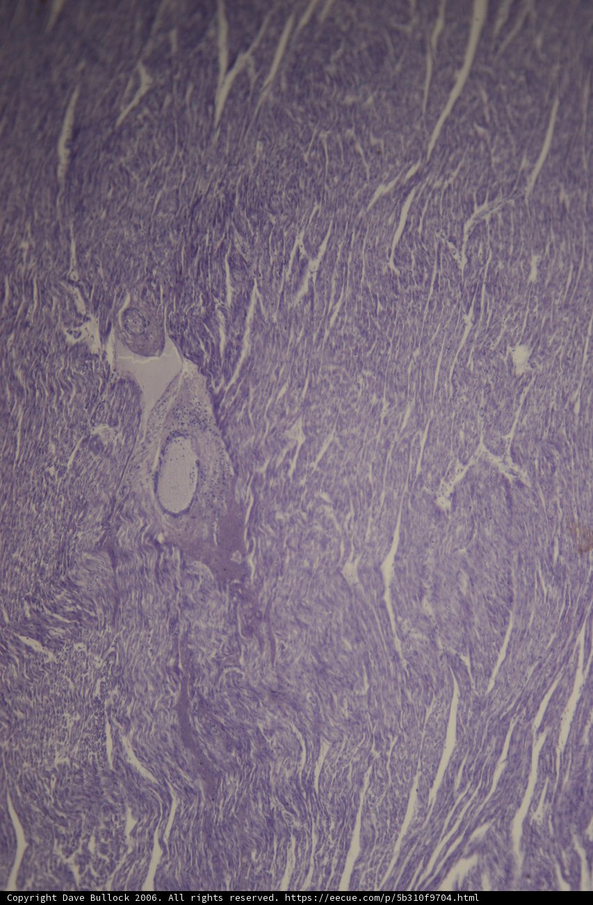 Purple Spots Texture