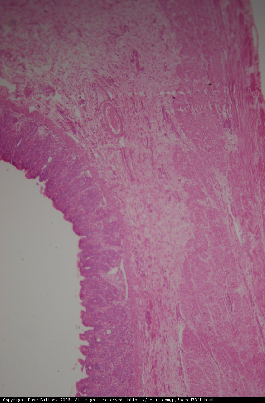Pink Tissue Stain