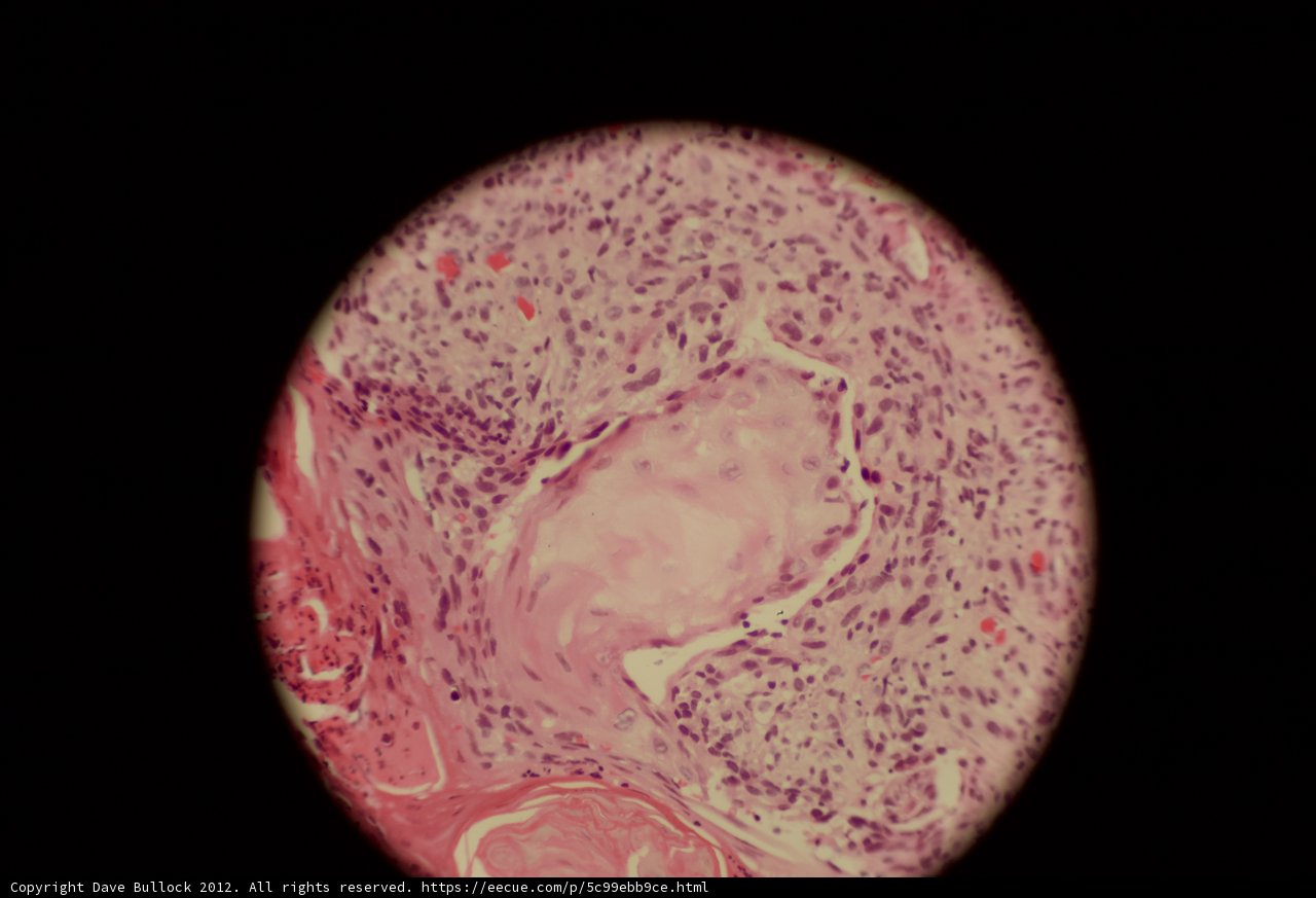 Skin Micrograph Reveals Intriguing Sphere Shape