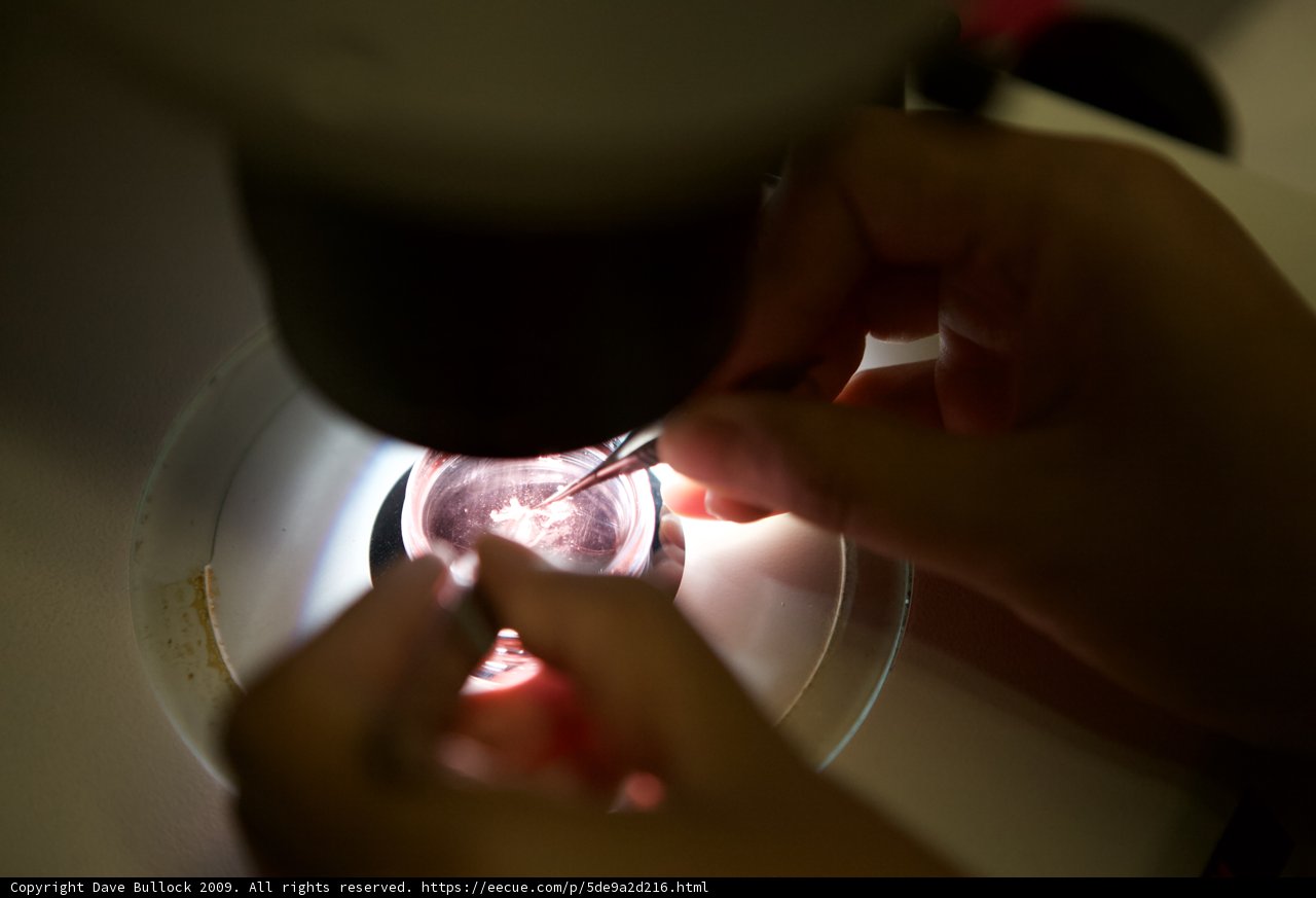 Microscopic Examination