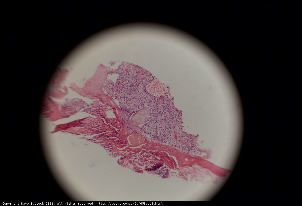 Vibrant Tissue Stain