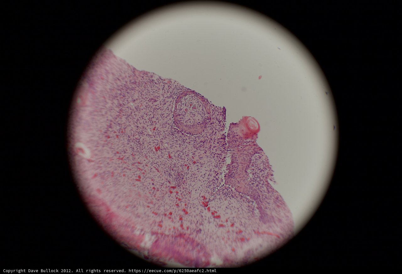 Tiny Tissue Sphere