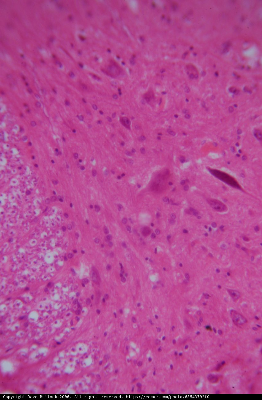 Spot the Pink Tissue