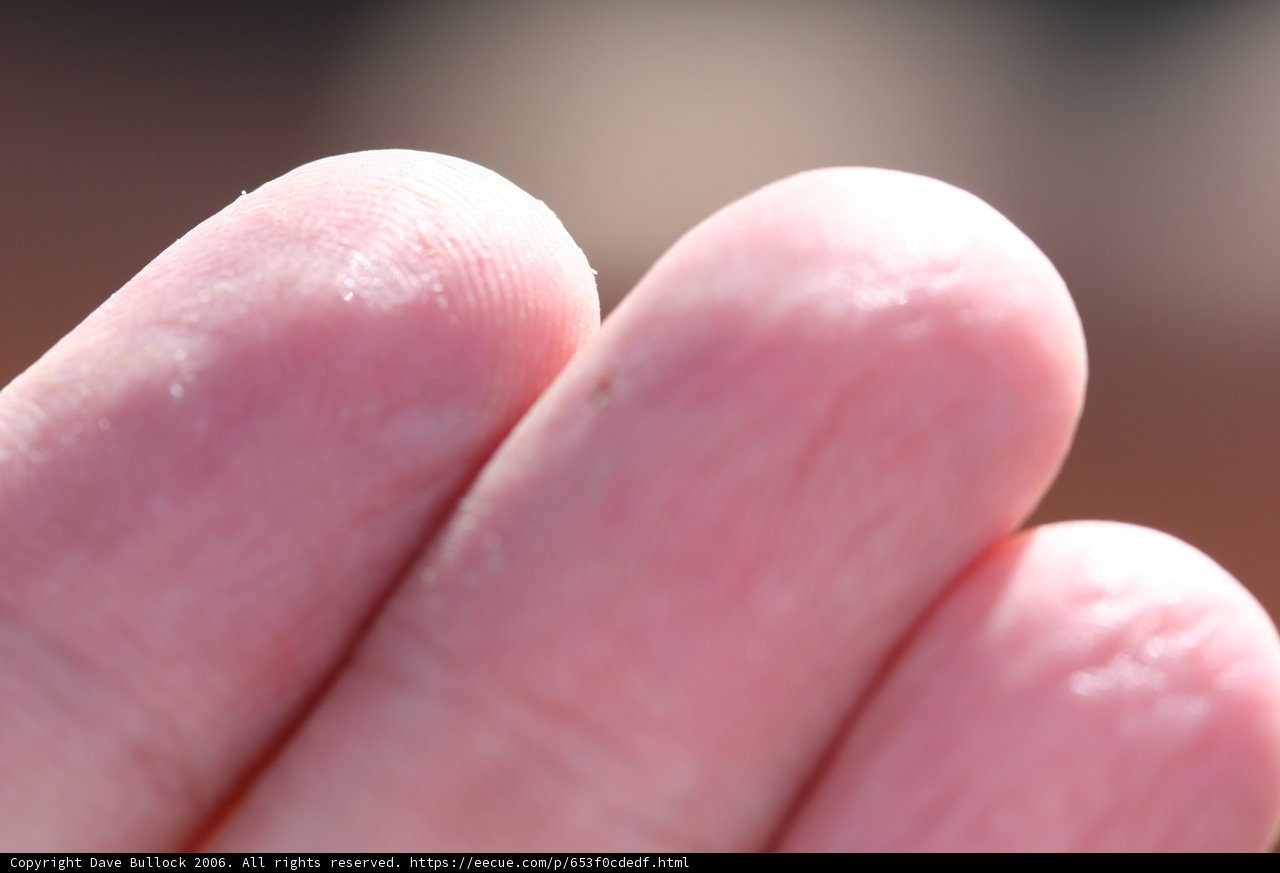 White Dot on Finger