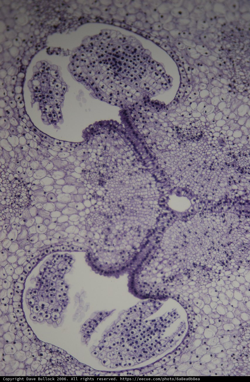 A Closer Look at the Human Kidney