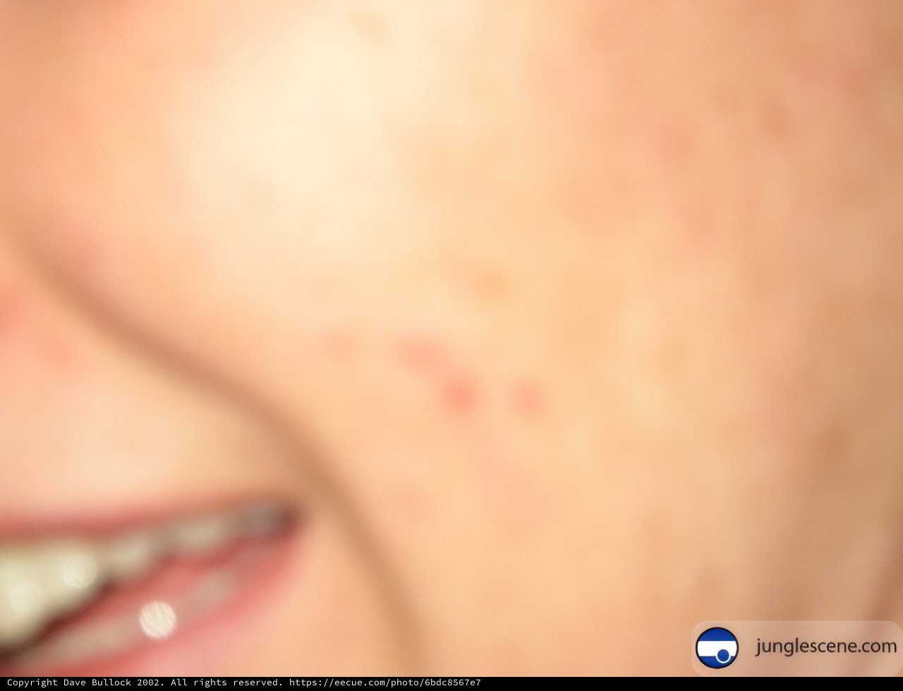 Freckled Beauty