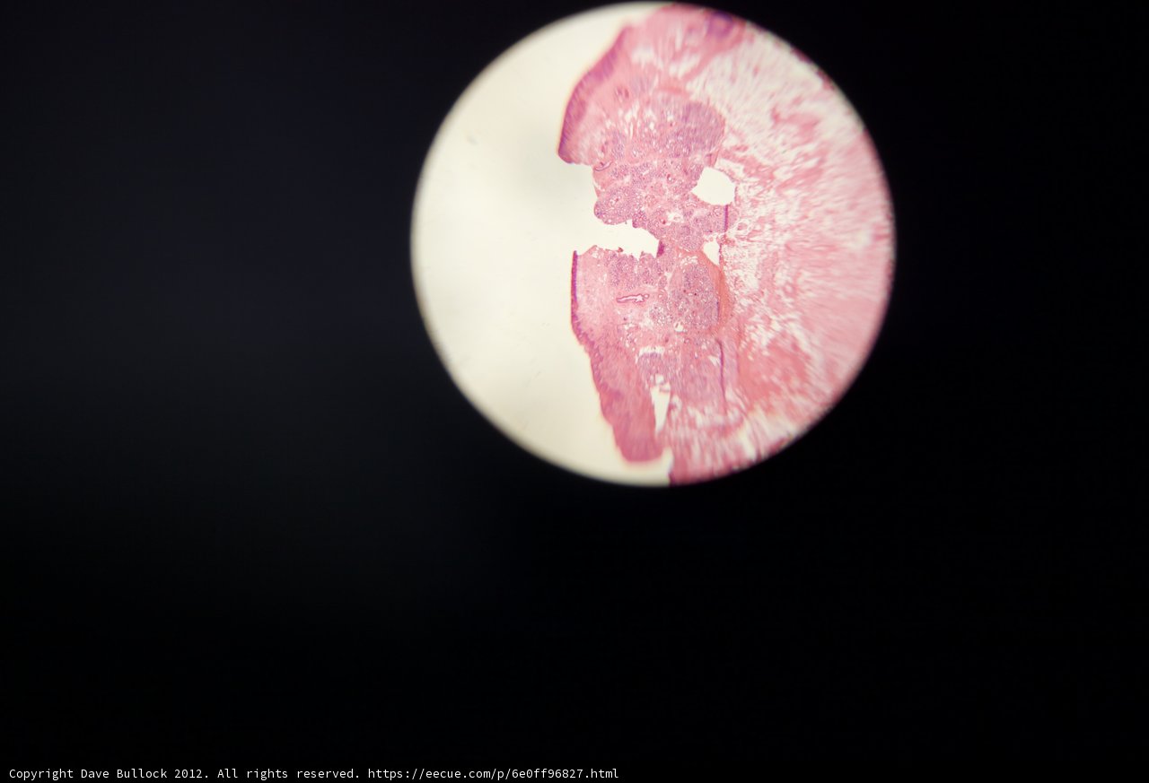 Pink and White Stained Sphere