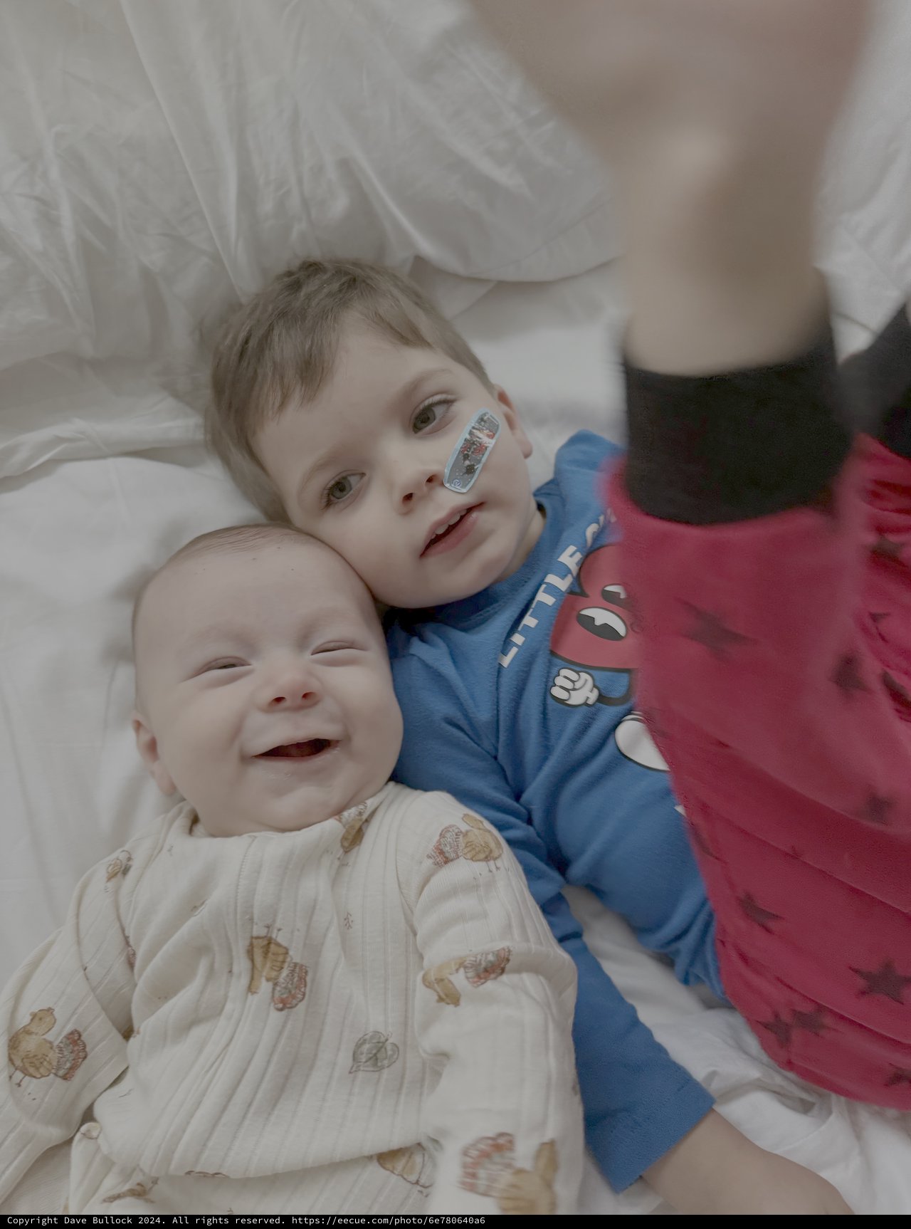 Two Happy Children Cuddling in Hospital Bed
