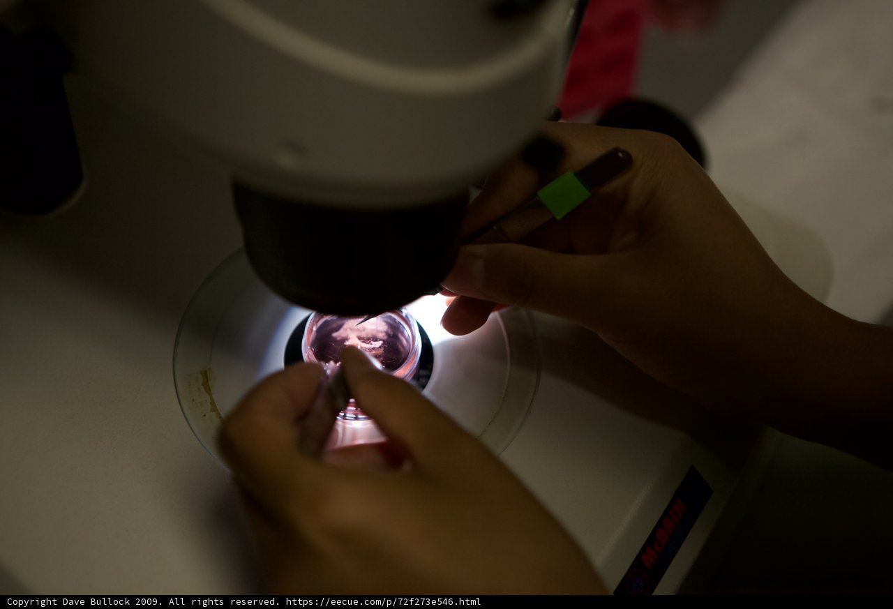 Microscopic examination