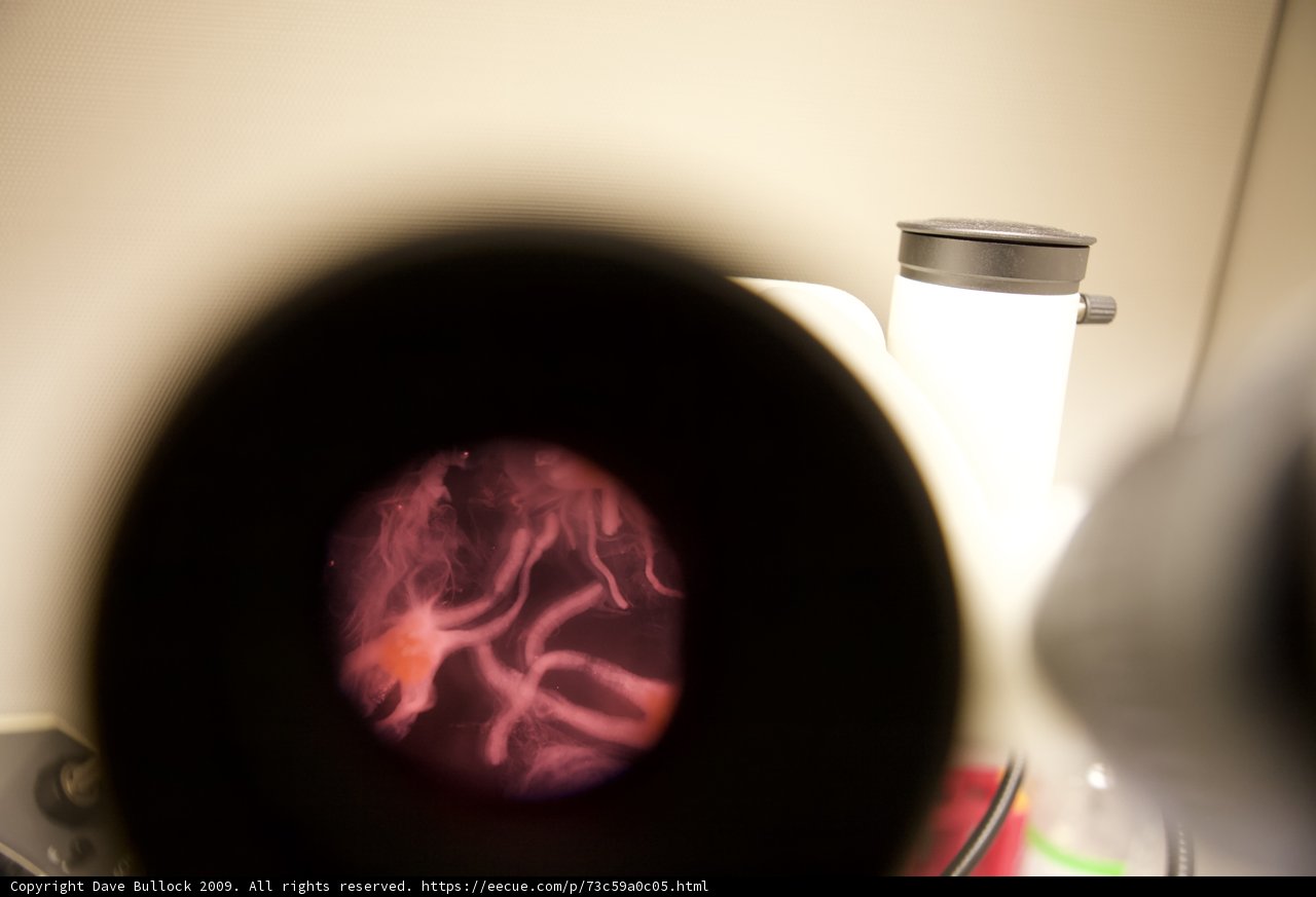 Under the Microscope: A Cat's Eye